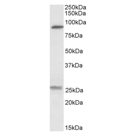 Western Blot - Anti-SLC4A11 Antibody (A84723) - Antibodies.com