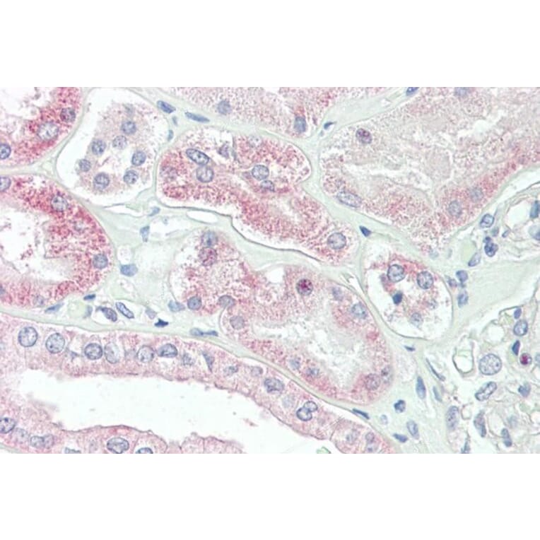 Immunohistochemistry - Anti-SLC4A11 Antibody (A84723) - Antibodies.com