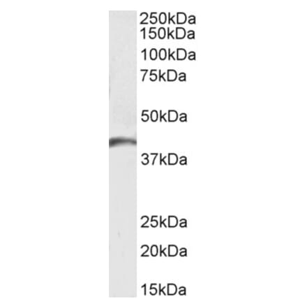 Western Blot - Anti-GPCR GPR17 Antibody (A84726) - Antibodies.com