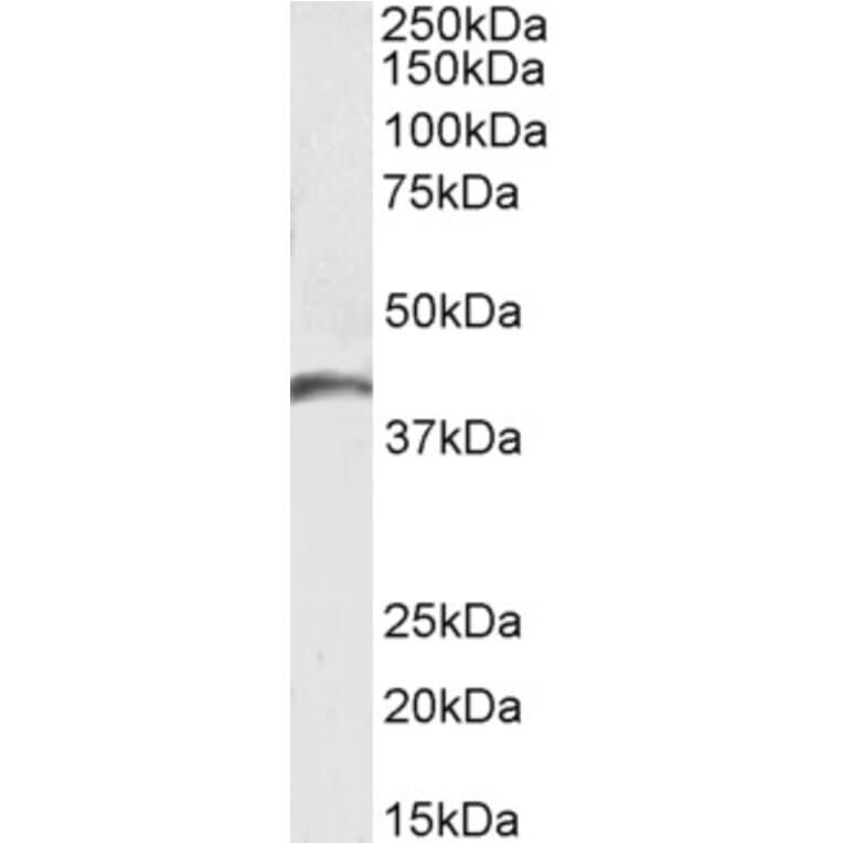 Western Blot - Anti-GPCR GPR17 Antibody (A84726) - Antibodies.com