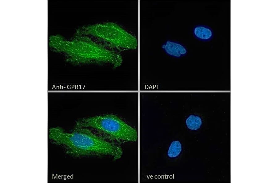 Immunofluorescence - Anti-GPCR GPR17 Antibody (A84726) - Antibodies.com