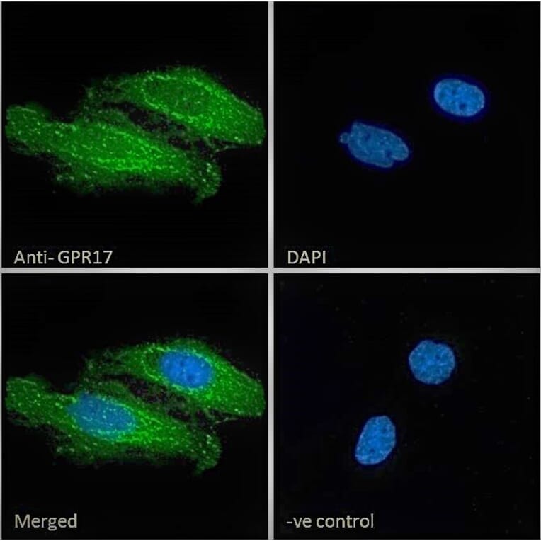 Immunofluorescence - Anti-GPCR GPR17 Antibody (A84726) - Antibodies.com