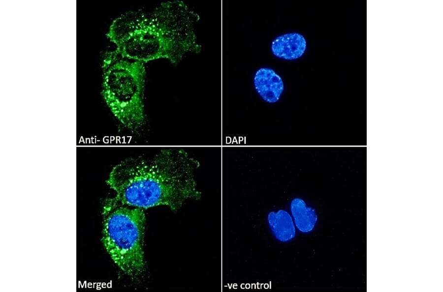 Immunofluorescence - Anti-GPCR GPR17 Antibody (A84726) - Antibodies.com