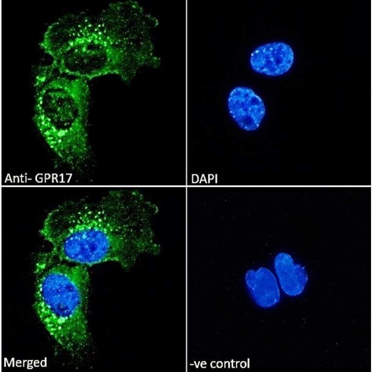Immunofluorescence - Anti-GPCR GPR17 Antibody (A84726) - Antibodies.com