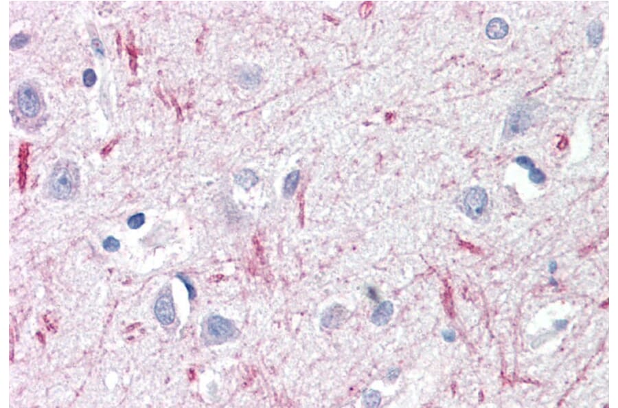 Immunohistochemistry - Anti-DTX3 Antibody (A84730) - Antibodies.com