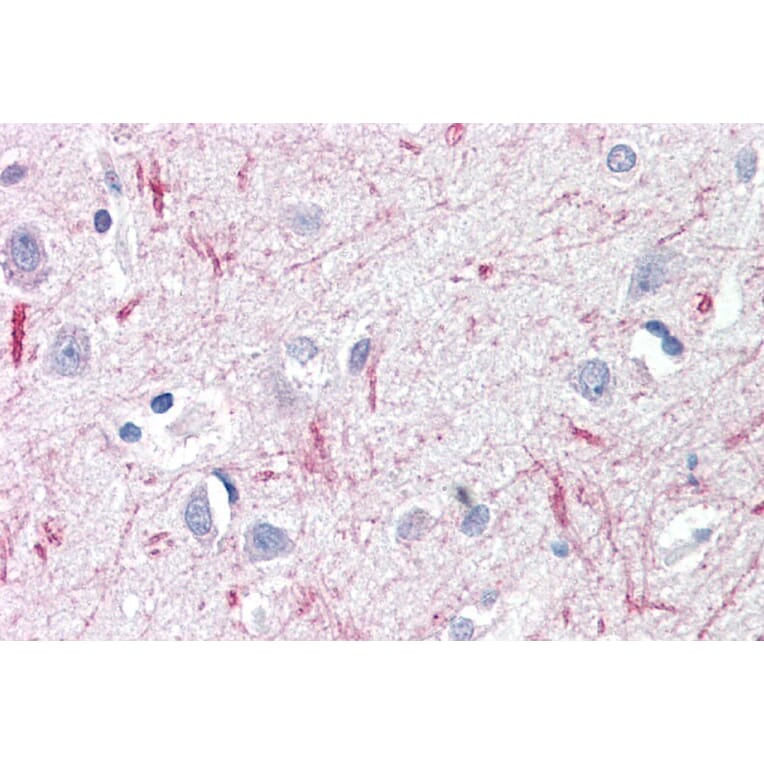 Immunohistochemistry - Anti-DTX3 Antibody (A84730) - Antibodies.com