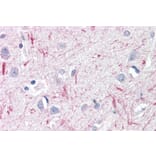 Immunohistochemistry - Anti-DTX3 Antibody (A84730) - Antibodies.com