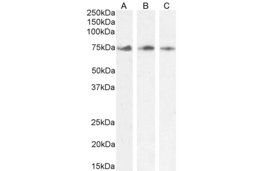 Western Blot - Anti-KLHL6 Antibody (A84731) - Antibodies.com