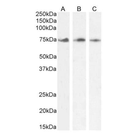 Western Blot - Anti-KLHL6 Antibody (A84731) - Antibodies.com