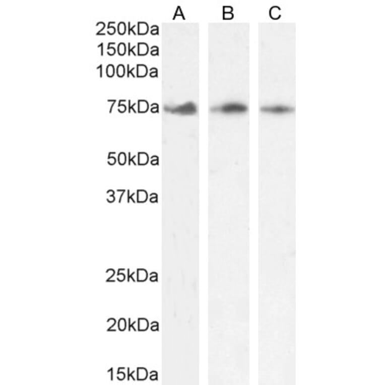 Western Blot - Anti-KLHL6 Antibody (A84731) - Antibodies.com