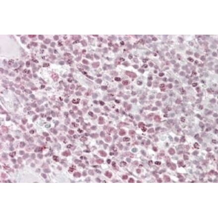 Immunohistochemistry - Anti-Ikaros Antibody (A84732) - Antibodies.com