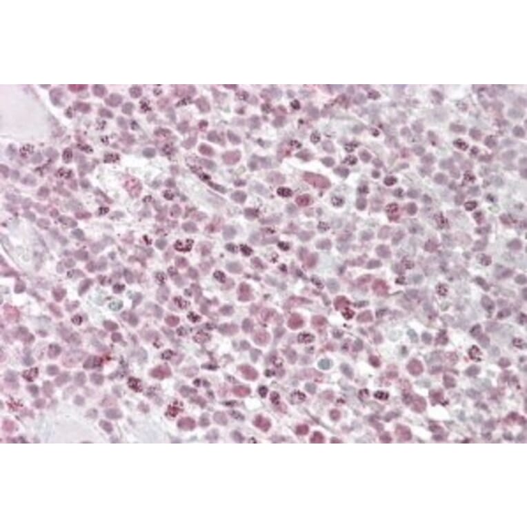 Immunohistochemistry - Anti-Ikaros Antibody (A84732) - Antibodies.com