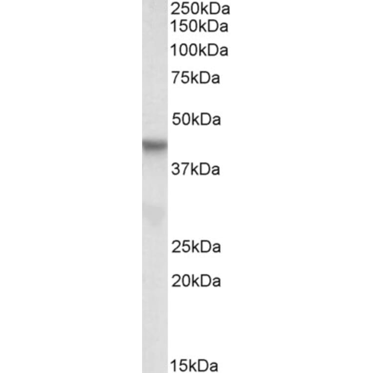 Western Blot - Anti-PINX1/LPTS Antibody (A84733) - Antibodies.com