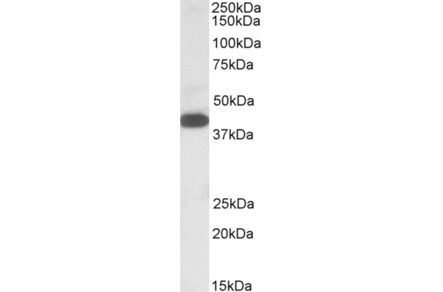 Western Blot - Anti-A4GNT Antibody (A84734) - Antibodies.com