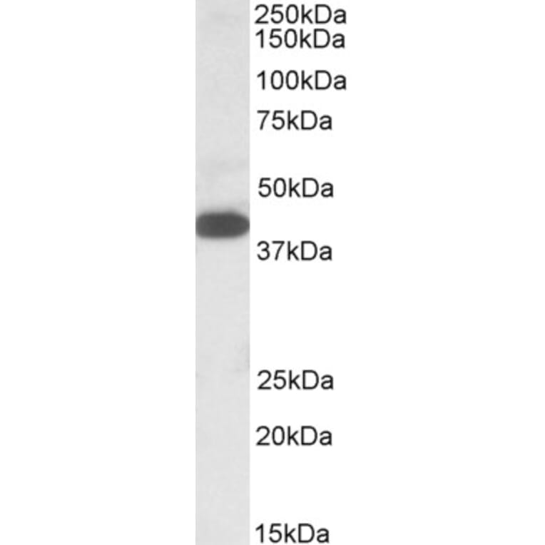 Western Blot - Anti-A4GNT Antibody (A84734) - Antibodies.com
