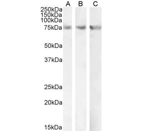 Western Blot - Anti-CPT2 Antibody (A84735) - Antibodies.com