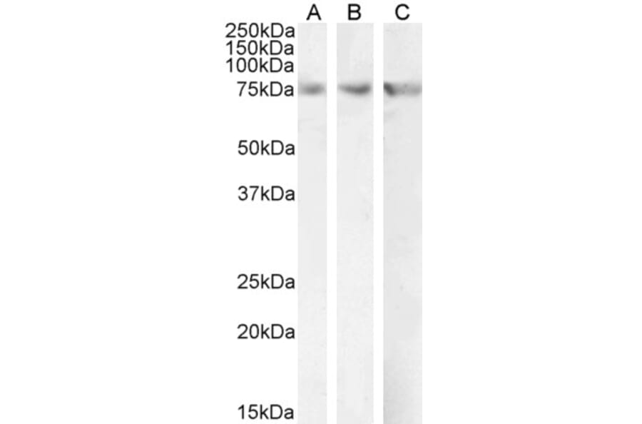 Western Blot - Anti-CPT2 Antibody (A84735) - Antibodies.com
