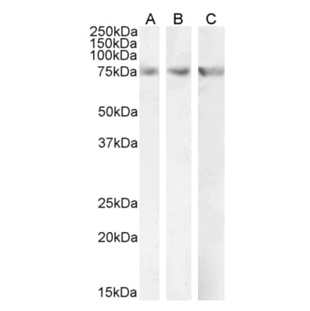 Western Blot - Anti-CPT2 Antibody (A84735) - Antibodies.com