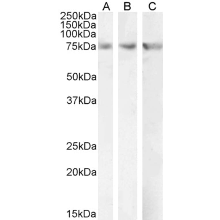 Western Blot - Anti-CPT2 Antibody (A84735) - Antibodies.com