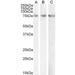 Western Blot - Anti-CPT2 Antibody (A84735) - Antibodies.com
