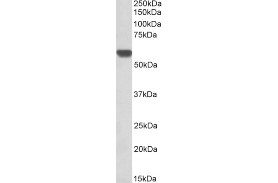 Western Blot - Anti-AMF Antibody (A84737) - Antibodies.com