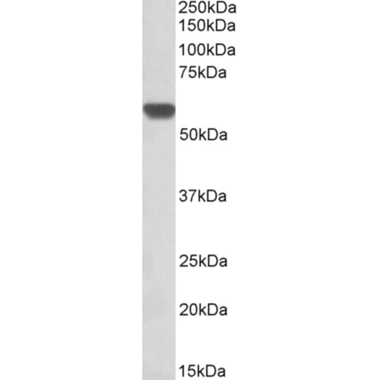Western Blot - Anti-AMF Antibody (A84737) - Antibodies.com