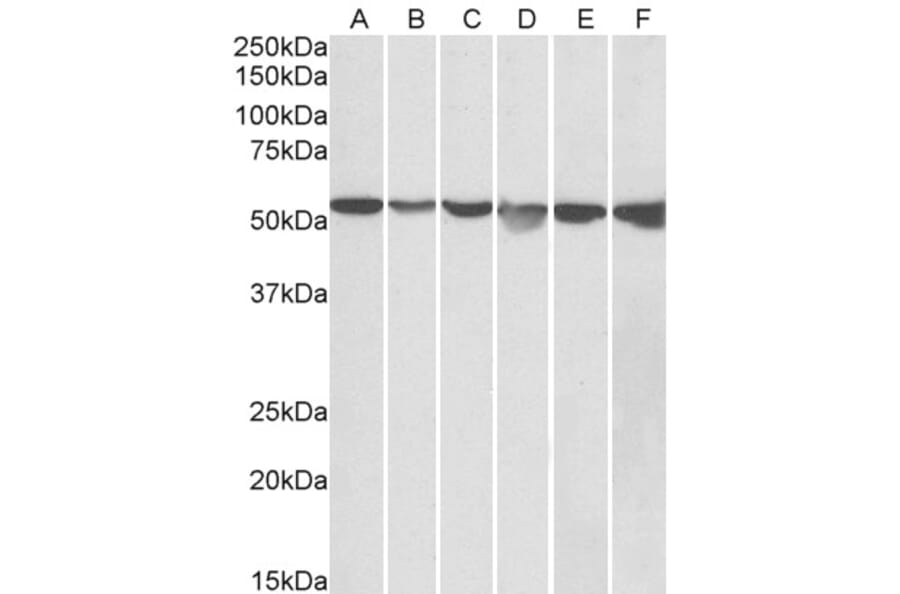 Western Blot - Anti-AMF Antibody (A84737) - Antibodies.com