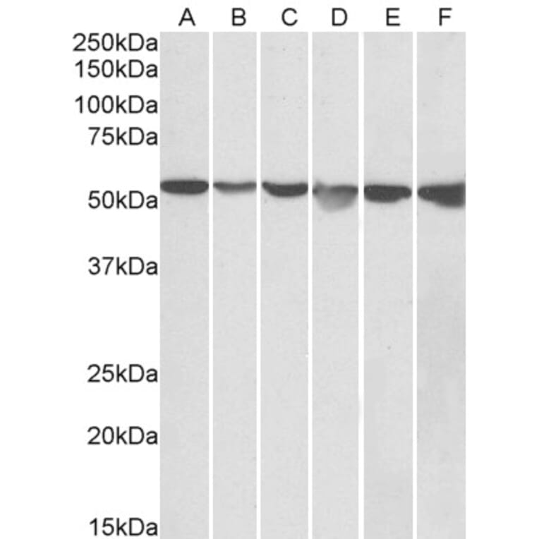 Western Blot - Anti-AMF Antibody (A84737) - Antibodies.com