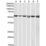 Western Blot - Anti-AMF Antibody (A84737) - Antibodies.com