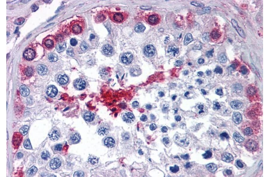 Immunohistochemistry - Anti-AMF Antibody (A84737) - Antibodies.com