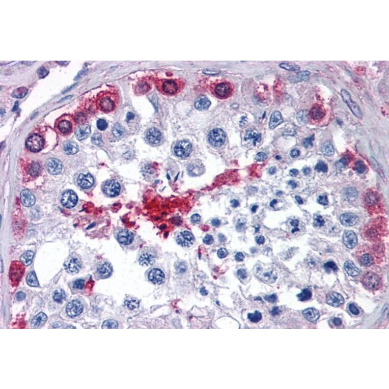 Immunohistochemistry - Anti-AMF Antibody (A84737) - Antibodies.com
