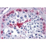 Immunohistochemistry - Anti-AMF Antibody (A84737) - Antibodies.com