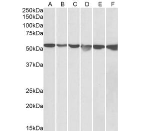 Western Blot - Anti-GPI Antibody (A84737) - Antibodies.com