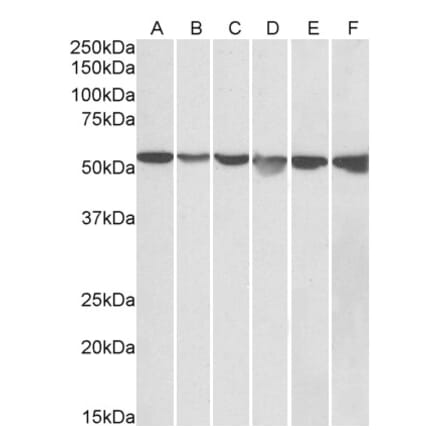 Western Blot - Anti-GPI Antibody (A84737) - Antibodies.com