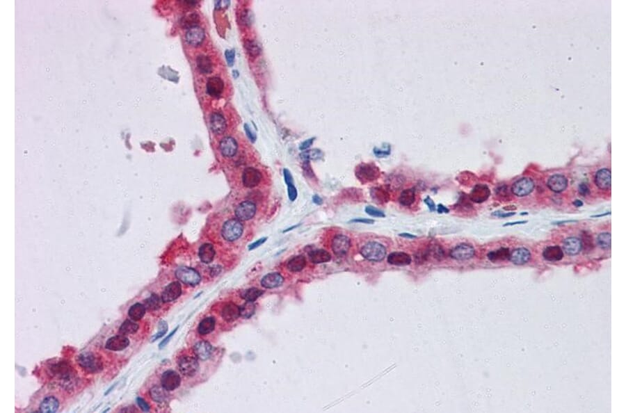 Immunohistochemistry - Anti-AMF Antibody (A84737) - Antibodies.com