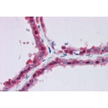Immunohistochemistry - Anti-AMF Antibody (A84737) - Antibodies.com
