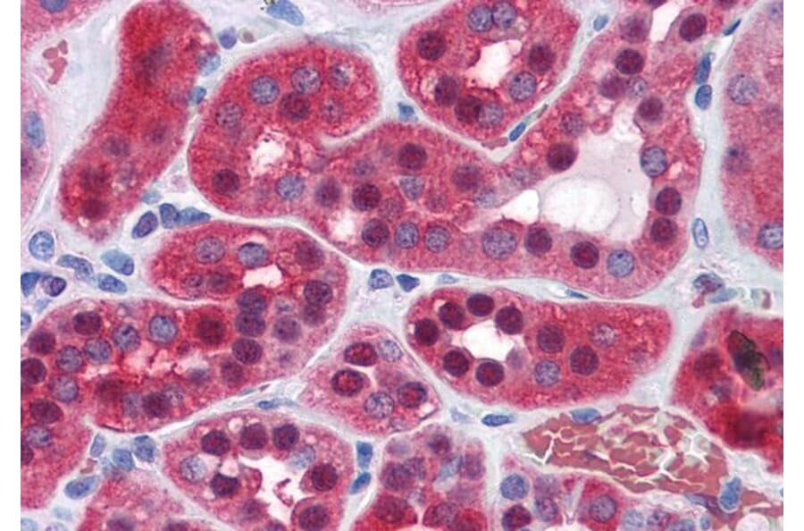 Immunohistochemistry - Anti-AMF Antibody (A84737) - Antibodies.com