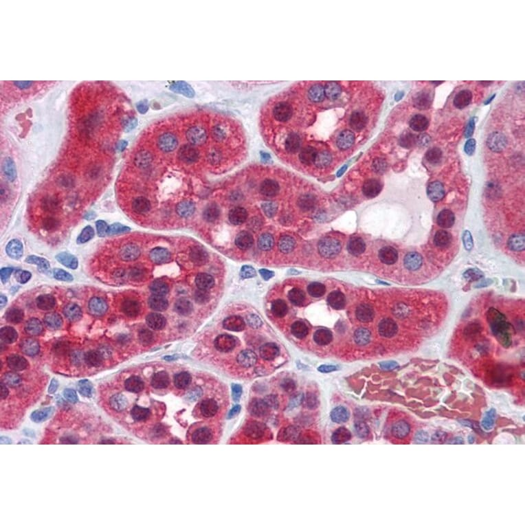 Immunohistochemistry - Anti-AMF Antibody (A84737) - Antibodies.com