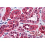 Immunohistochemistry - Anti-AMF Antibody (A84737) - Antibodies.com