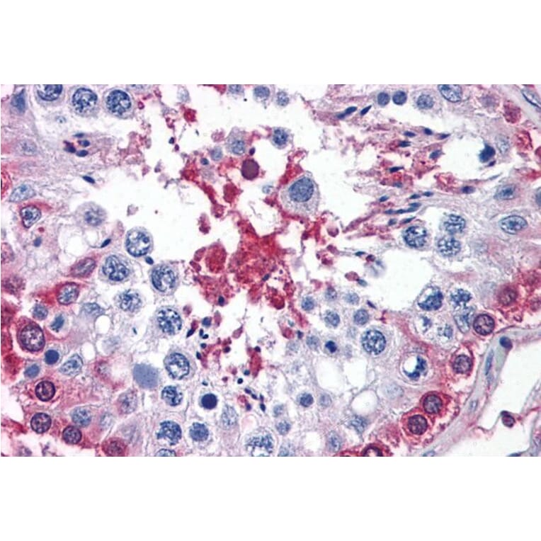 Immunohistochemistry - Anti-AMF Antibody (A84738) - Antibodies.com