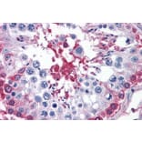 Immunohistochemistry - Anti-AMF Antibody (A84738) - Antibodies.com