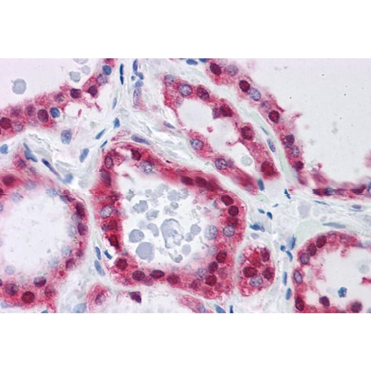 Immunohistochemistry - Anti-AMF Antibody (A84738) - Antibodies.com