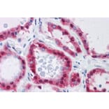 Immunohistochemistry - Anti-AMF Antibody (A84738) - Antibodies.com