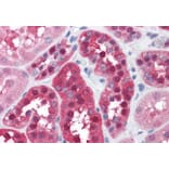 Immunohistochemistry - Anti-AMF Antibody (A84738) - Antibodies.com