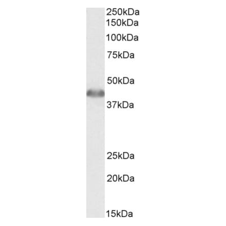 Western Blot - Anti-ACAT1 Antibody (A84739) - Antibodies.com