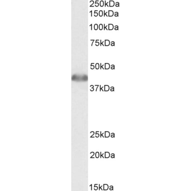 Western Blot - Anti-ACAT1 Antibody (A84739) - Antibodies.com