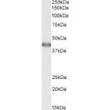 Western Blot - Anti-ACAT1 Antibody (A84739) - Antibodies.com