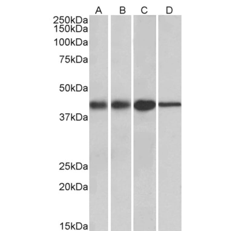 Western Blot - Anti-ACAT1 Antibody (A84739) - Antibodies.com