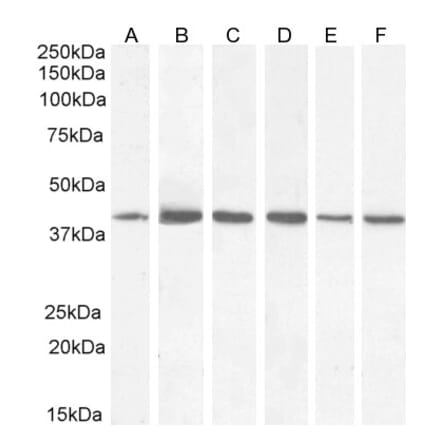 Western Blot - Anti-ACAT1 Antibody (A84741) - Antibodies.com