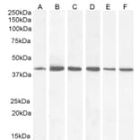 Western Blot - Anti-ACAT1 Antibody (A84741) - Antibodies.com